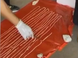 Восемьнадцатиметрового глиста обнаружили у жителя Таиланда