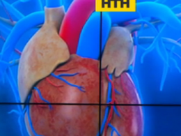 Інфаркти та інсульти почастішали серед тих, хто перехворів на коронавірус